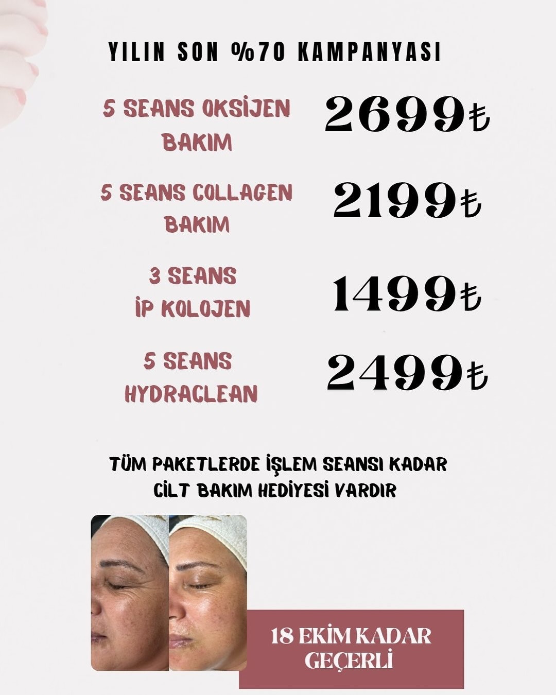 Lavinyas Güzellik Salonu